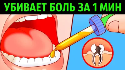 10 Способов Убить Зубную Боль за Минуту - YouTube