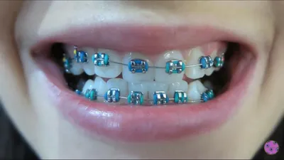 Pin on Supreme Dental