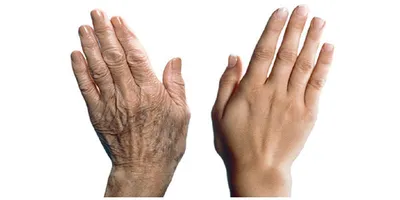 Экспресс-омоложение кожи рук | Tori Clinic | Дзен