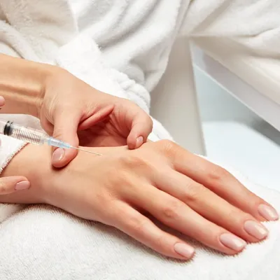 Омоложение кожи рук с помощью биоревитализации: эффект процедуры, фото до и  после