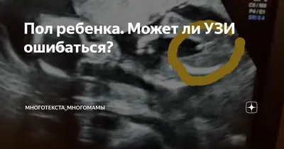 Определение пола ребёнка по крови матери, цена - Геном в Волгограде