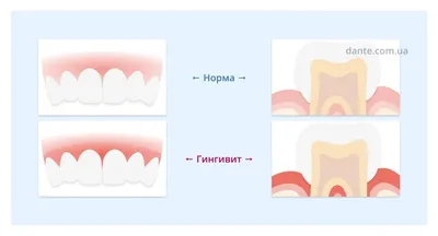 Как облегчить зубную боль у ребенка перед визитом к врачу?