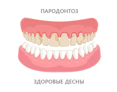 Воспалилась десна после лечения зуба | Ответы на стомпрактика.рф