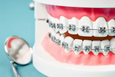 Чем занимается ортодонтия? - Экстрадент