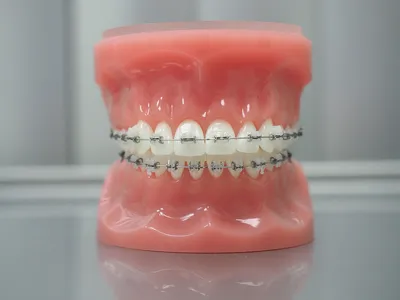 Ортодонтия - Денталия - Клиника эстетической стоматологии