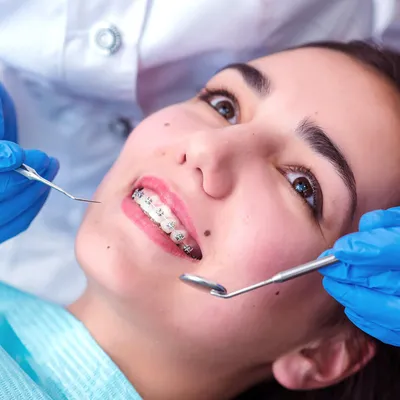 Ортодонтия в Благовещенске 🌟 в клинике AFIDENT | ортодонтическое лечение  по исправлению прикуса зубов у лучших ортодонтов