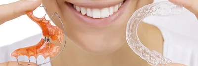 Ортодонтия: исправление прикуса, ретейнеры, элайнеры, брекет-системы