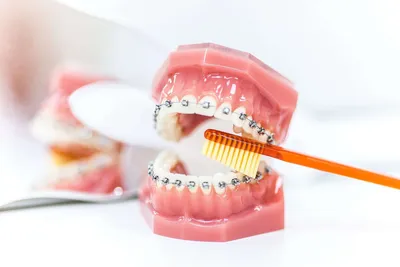 Ортодонтия: цены на услуги в стоматологии Deva-Dent в Москве