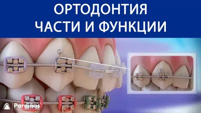 Ортодонтия. Брекеты для детей и взрослых в Одессе. - Hellas Dental