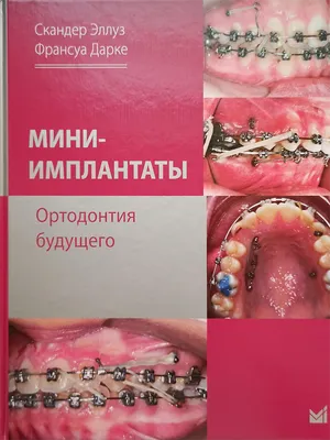 Ортодонтия (брекеты и безбрекетные системы) - Клиника Бондаренко