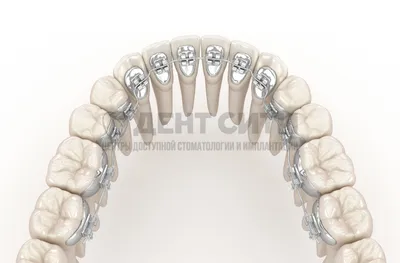 Ортодонтия - СтоматЛар