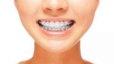 Ортодонтия взрослых | Мелсен Бирте - купить с доставкой по выгодным ценам в  интернет-магазине OZON (223469060)