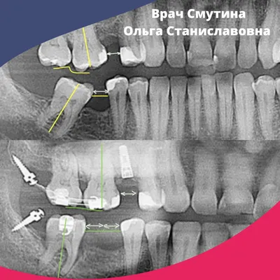 Ортодонтия в Екатеринбурге | Цены в клинике Dr. Yun