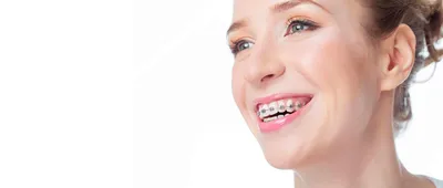 Компьютерная 3д ортодонтия для цифрового лечения прикуса, демонстрация  цифровой челюсти с бесплатной программой Avantis 3D