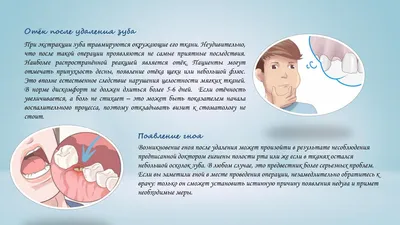 Воспалилась десна после удаления зуба: почему так происходит и что нужно  делать?