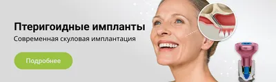 Стоматологическая клиника \"HomeDent\" - Что делать, если после удаления зуба  в лунке остался осколок⁉ ⠀ ✓Во-первых, не стоит ставить себе такой диагноз  самостоятельно. ⠀ Нередко за осколок зуба люди принимают острый край