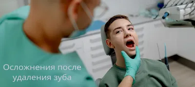 После удаления зубов: образ жизни, питание и правила гигиены - рекомендации  специалистов