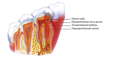 Удаление зуба мудрости - когда это действительно необходимо