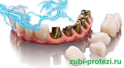 Лечение оскомины зубов