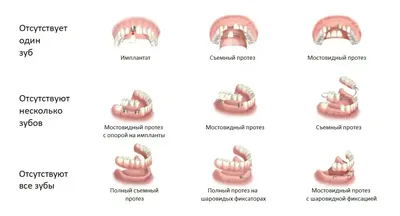 Как снять боль после отбеливания зубов — ROOTT