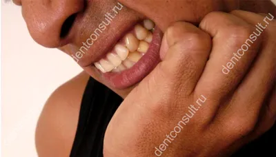 Когда оскомина на зубах – что это за ощущение, отчего появляется и когда  указывает на проблемы - dentconsult.ru