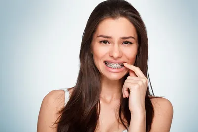 Повышенная чувствительность твердых тканей зубов (гиперестезия)
