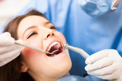 Болят зубы после установки брекетов - сколько это длится и что делать
