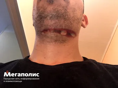Петербуржец добивается увольнения стоматолога, из-за которого чуть не умер  — Мегаполис