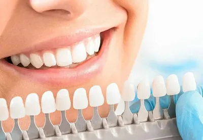 Отбеливание зубов Тверь - цена в стоматологии Династия Н