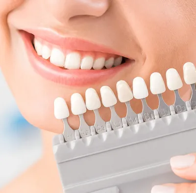 Профессиональное отбеливание зубов цена в Москве в стоматологии Лимон