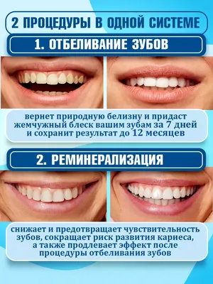Отбеливание зубов Zoom 4 в Москве за 14500р. - отзывы, цена, акции и скидки