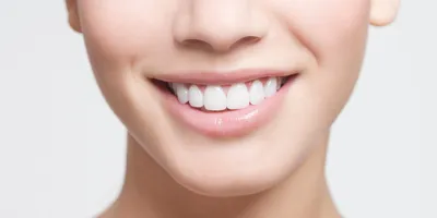Косметическое отбеливание зубов White Magic со скидкой 10% от Slivki.by