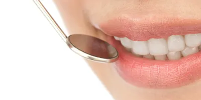 Отбеливание зубов дома: как отбелить зубы дома при помощи средств из ручной  продажи и не навредить зубам? | Medshop24