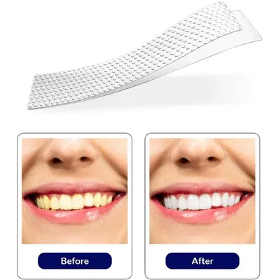Отбеливание зубов | Акция 2024 | Стоматология Dental Park