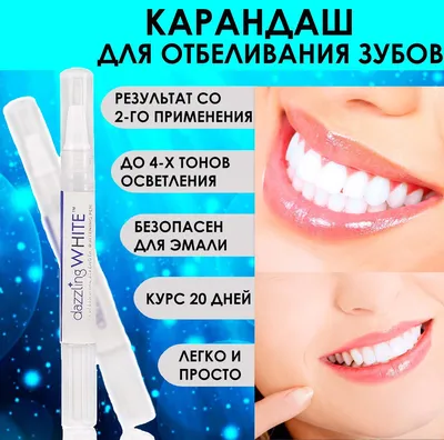 Отбеливание зубов: виды, показания, рекомендации | Smile Factory