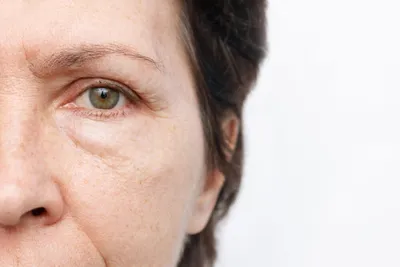 11 хитростей дерматологов как быстро снять отек лица | ЮниLook