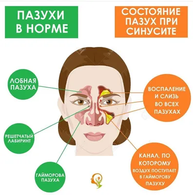 Воспаление слизистой носа - диагностика и лечение в 100med