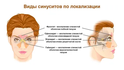 Как быстро проходят отеки после пластики носа?