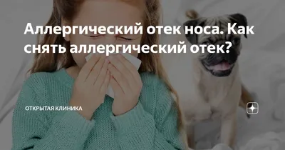 ОТЕК СЛИЗИСТОЙ носа на РАСШИФРОВКЕ КТ придаточных пазух. Отек слизистой  ГАЙМОРОВЫХ пазух. - YouTube