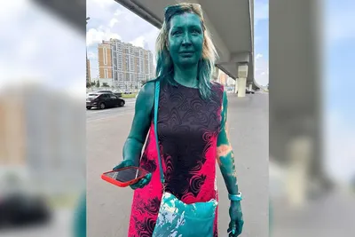 Почему зеленку не используют на Западе? Она действительно опасна?  Разбираемся с врачом - Sport24