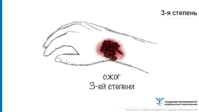 Казанский репортер: Навальному плеснули в лицо зеленкой, он получил  химический ожог глаза