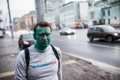 Любовные разборки при помощи зеленки! После встречи с бывшей женой  бойфренда девушке грозит потеря зрения