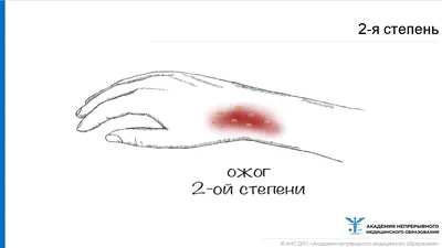Новороссийскую студентку, пытавшую подругу зеленкой, отправили подметать  улицы - KP.RU