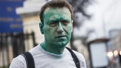 Химический ожог глаза получил Навальный после нападения неизвестного с  зеленкой : Псковская Лента Новостей / ПЛН