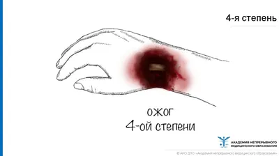 ELEV Антисептический гель китайская зеленка