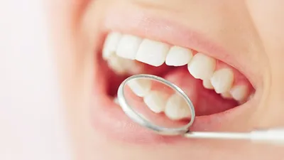 5 главных причин, почему появилось жжение во рту после установки протеза |  Всё о ваших зубах | Дзен