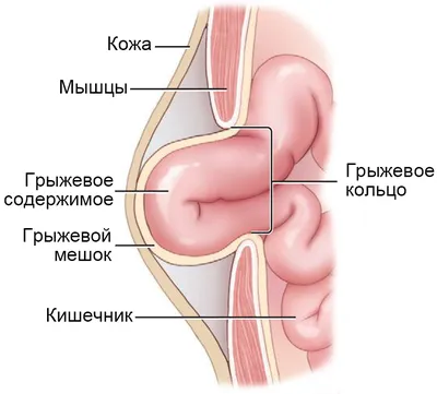 Оригинальные фото паховой грыжи у кошки в формате jpg