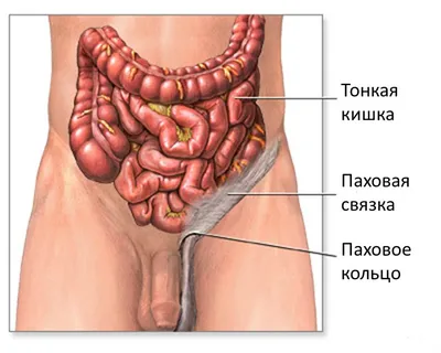 Паховый бандаж Lauftex мужской р.XL бежевый - купить в интернет-магазинах,  цены на Мегамаркет | ортопедические бандажи 4603281880123