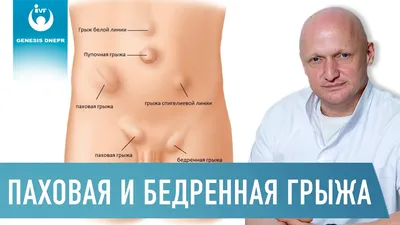 Пупок для новорожденных, пупок и пупка для детей | AliExpress