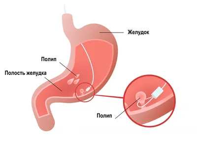 Удаление папиллом в ЮАО (Южный округ) рядом со мной на карте, цены -  Удалить папилломы: 163 медицинских центра с адресами, отзывами и рейтингом  - Москва - Zoon.ru